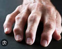 Arthritis Centres